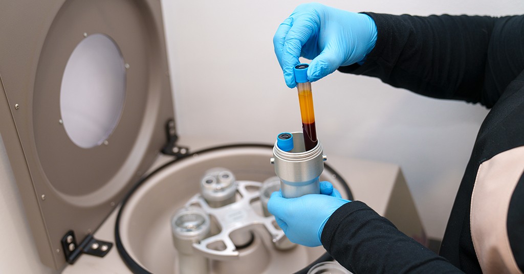 How PRP Treats Tendons and Ligaments
