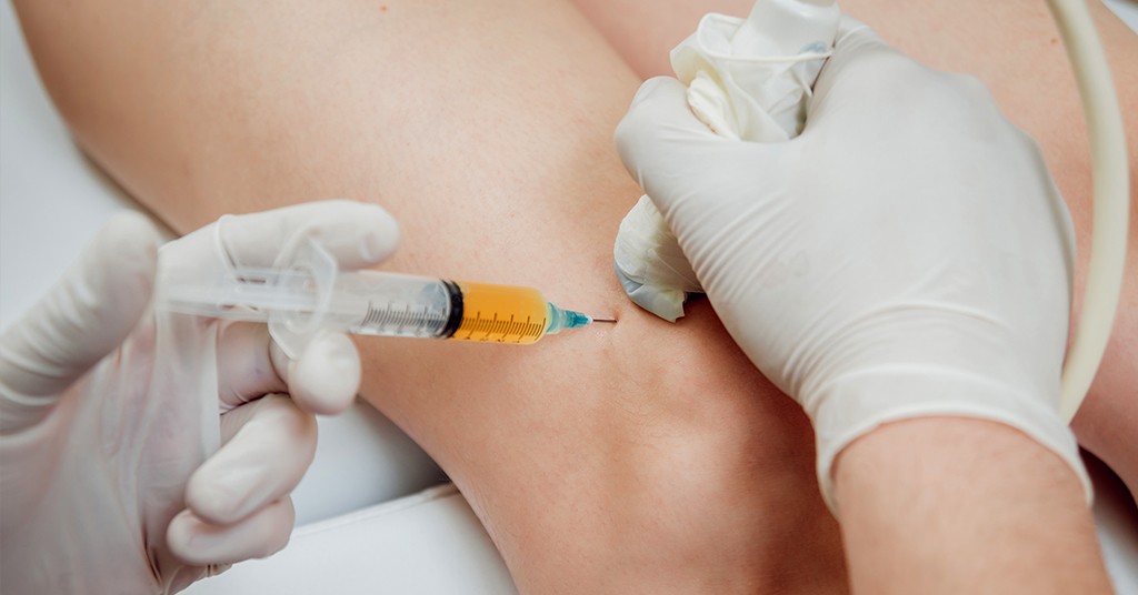 Prolotherapy for Joints That Feel Loose or Weak